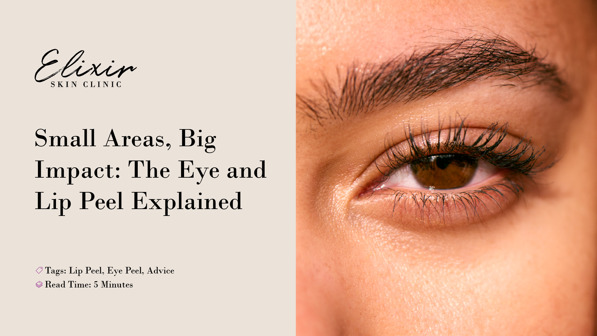 Eye and Lip Peel Doncaster